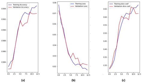Brain Tumor Detection and Classification Using Deep Learning and Sine ...