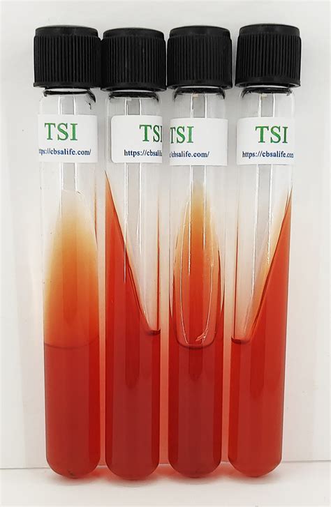 CBSAlife Triple Sugar Iron (TSI) Agar | CBSAlife