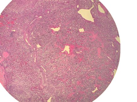 Cramps Diarrhea And Sweating at Sam Jones blog