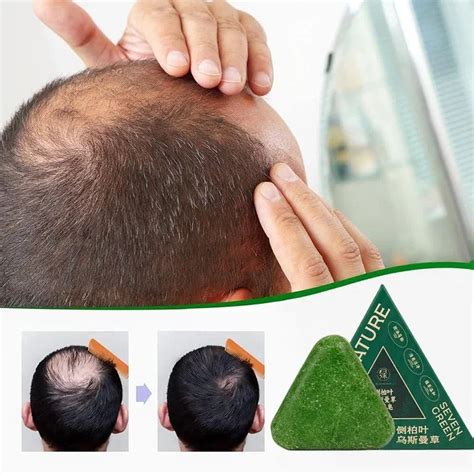 Herbal Anti-Hair Loss Shampoo Bar