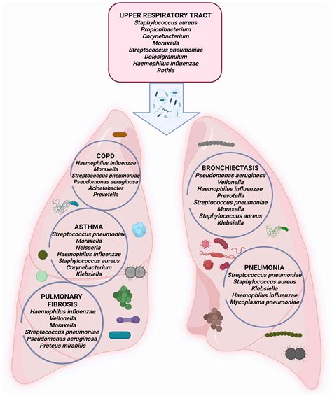Air-Conditioner Lung Meaning at Gene Courtney blog