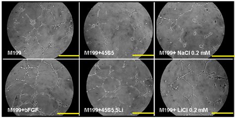 In Vitro Human Umbilical Vein Endothelial Cells Response to Ionic ...