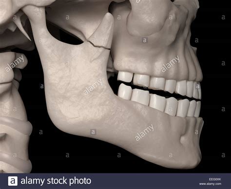 Coronoid High Resolution Stock Photography and Images - Alamy