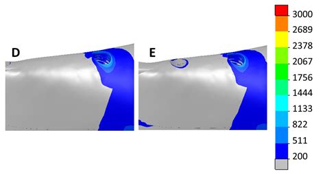 Implant-Supported Prostheses in the Edentulous Mandible: Biomechanical ...
