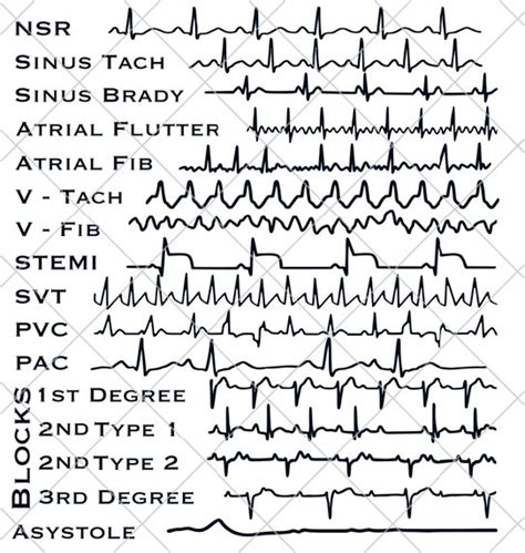 EKG Strips SVG | Cardiac Monitor | Nurse, Technician, Doctor Gift | Digital Download - Etsy