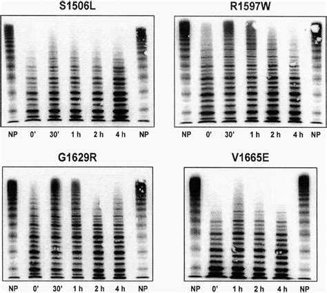 Diagnostic Differentiation of von Willebrand Disease Types 1 and 2 by ...