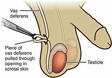 meaning of vas vas deferens definition location function and related meaning of vas vas deferens definition location function and related