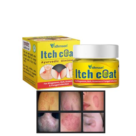 Buy Vidhmaan Itch Coat Anti fungal Malam - for Ringworm, , Eczema ...