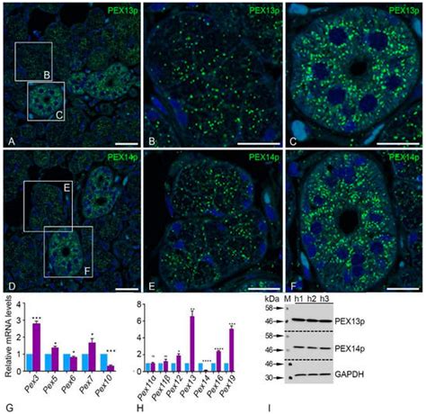 Peroxisomes Are Highly Abundant and Heterogeneous in Human Parotid Glands
