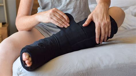 A Patient’s Guide To Lymphovenous Bypass Surgery