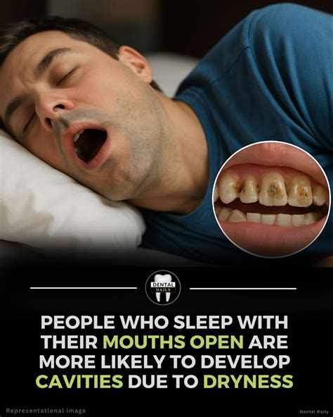 Mouth Breathing at Night? Here’s Why It’s Destroying Your Teeth (And ...