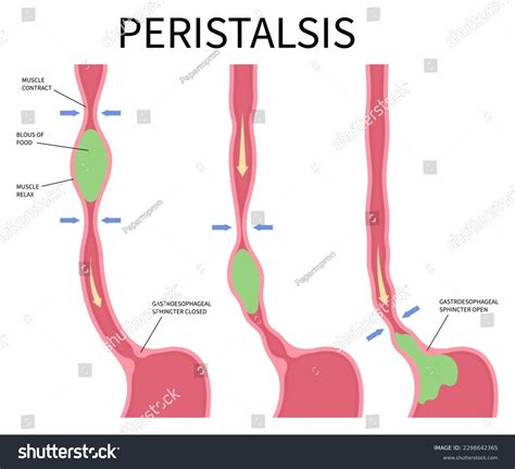 Problems With Peristalsis