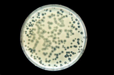 Free clip invade bacterias, Download Free clip invade bacterias png images, Free ClipArts on ...
