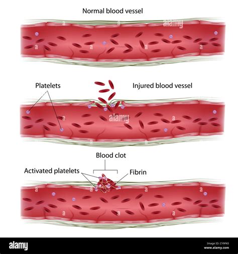Process of Blood Clotting 的图像结果