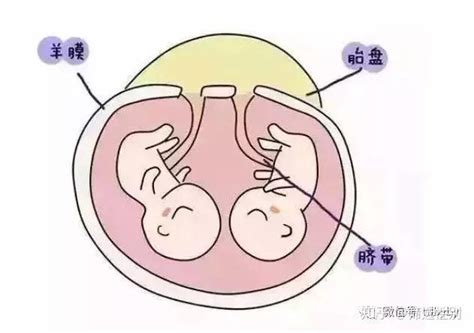 龙凤胎和双胞胎区别 - 形成几率、怀孕方法及取名技巧 - 久久助孕网