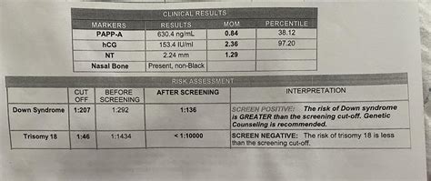 Positive nip test for trisomy 21 : r/NIPT