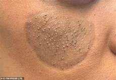 Pubic Hairstyle by 30 Reveals She Was Left With Pubic Hair Growing On Pubic Hairstyle
