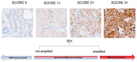 Navigating HER2-Low Testing in Invasive Breast Cancer: Update ...