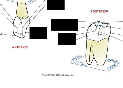 Line Angle Teeth 的图像结果