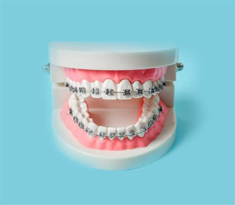Orbit Dental Clinic Implant Center