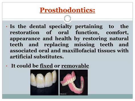 Terminology and classification of fixed prosthodontics | PDF