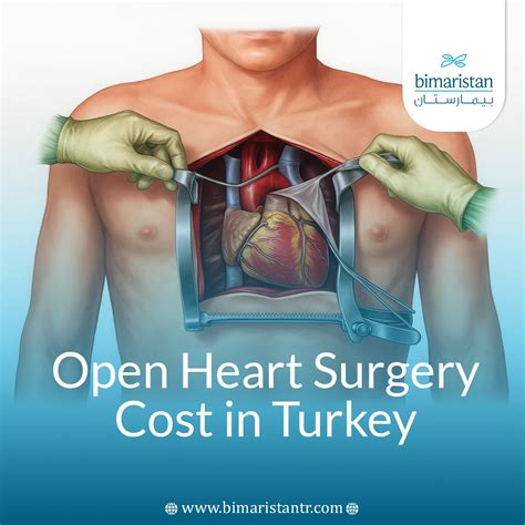 Open Heart Surgery Cost in Turkey: 2025 Price Overview