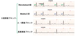 Image result for Computer in Teaching Learning Process