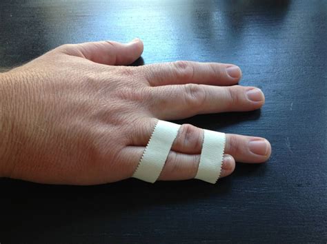 Quick Guide to Buddy Taping Your Finger | Finger injury, Broken finger ...