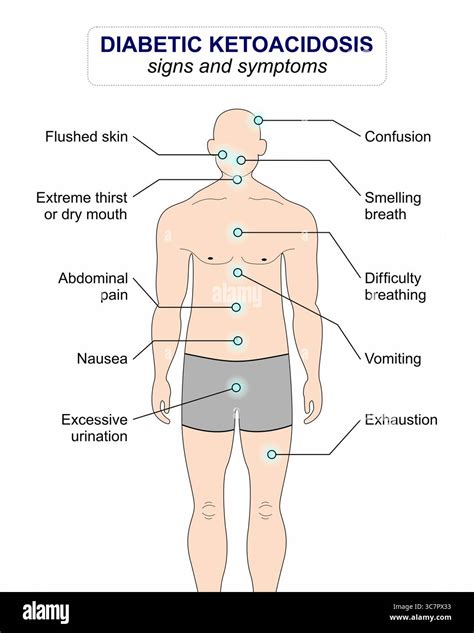 Diabetic Ketoacidosis (DKA) sign and symptoms Stock Photo - Alamy