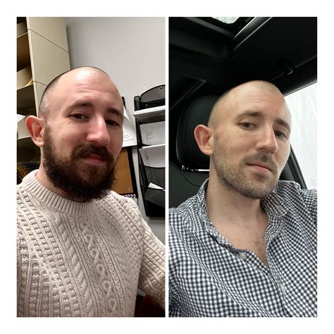 Beard vs No Beard : r/beards