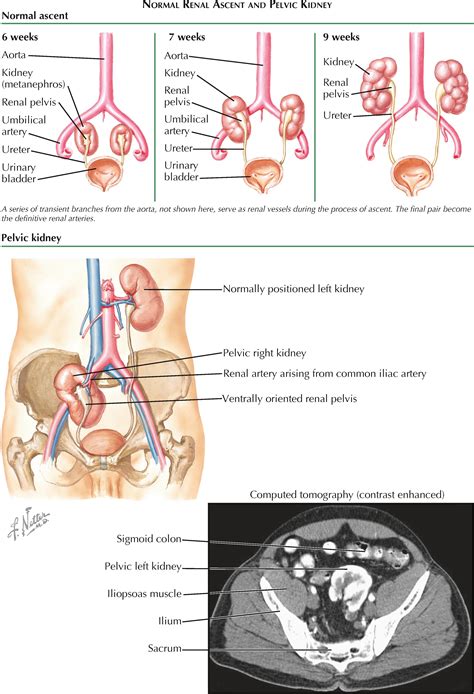NORMAL AND ABNORMAL DEVELOPMENT - Clinical Tree