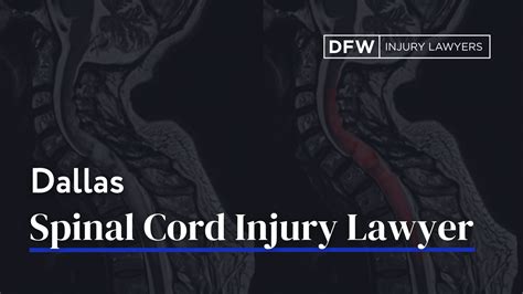 Dallas Spinal Cord Injury Attorney | DFW Injury Lawyers