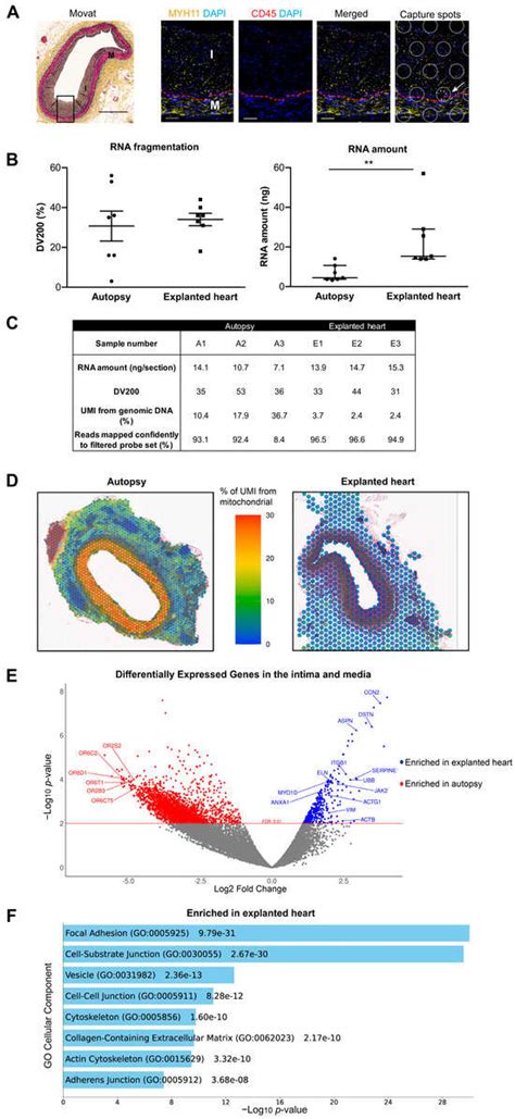 Spatial Gene Expression of Human Coronary Arteries Revealed the ...