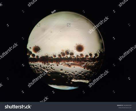 Bacteria Reproducing Under a Microscope 的图像结果