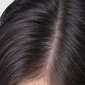 Ayurvedic Anti Dandruff Shampoo | K P Namboodiri's