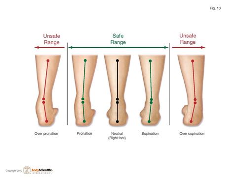 Supination vs. Pronation (plantar) | 발 건강, 물리치료, 해부학