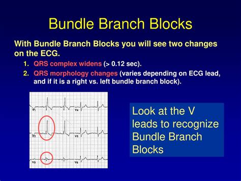 Image result for Insurance Principles Vector
