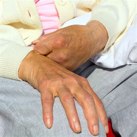 Paralysis: 40ರ ಆಸುಪಾಸಿನವ್ರಿಗೇ ಅಟ್ಕಾಯಿಸಿಕೊಳ್ಳೋದ್ಯಾಕೆ ಸ್ಟ್ರೋಕ್ ಸೈತಾನ್‌? ಈ ...