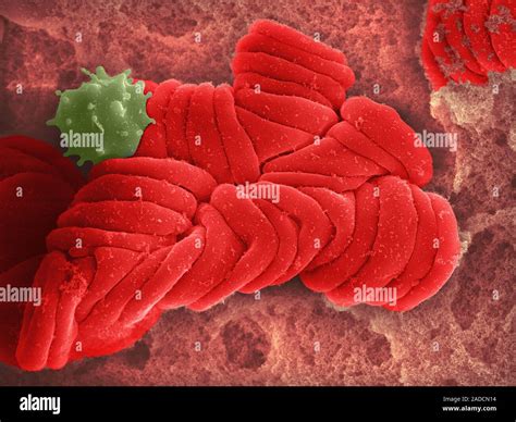 Blood clot. Coloured scanning electron micrograph (SEM) of red blood ...
