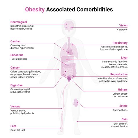Obesity Associated Comorbidities | BioRender Science Templates