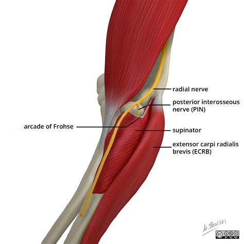 Radiopaedia - Drawing Radial nerve at elbow - English labels | AnatomyTOOL