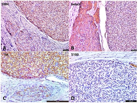 Developmental Parallels Between the Human Organs of Zuckerkandl and ...