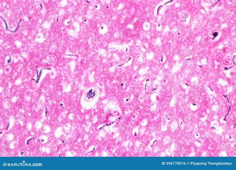 Human Nervous System Under the Microscope in Lab. Stock Photo - Image ...