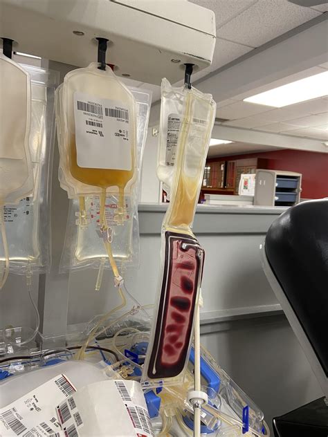 Platelet Donation Side Effects : r/Blooddonors