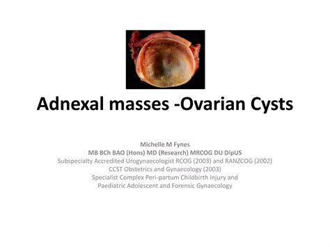 Adnexal masses - Ovarian Cysts (2008) | PDF
