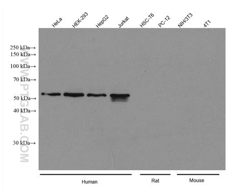 PEX14 (human specific) antibody (80196-1-RR) | Proteintech