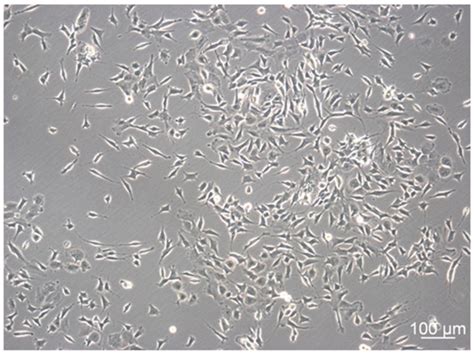 Streamlining Culture Conditions for the Neuroblastoma Cell Line SH-SY5Y ...