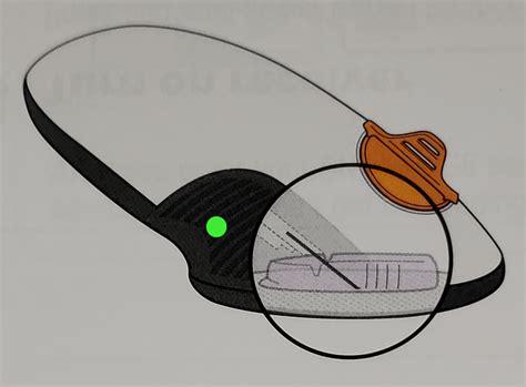 Dexcom G6 Problems 的图像结果