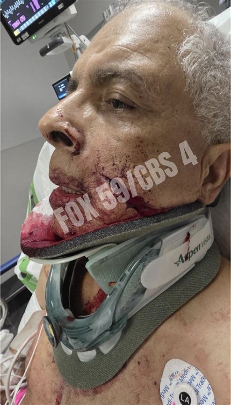 Mark Sanchez's alleged victim fights back in court