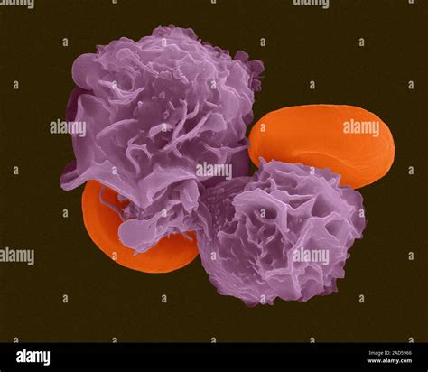 Abs Granulocytes (Anc) at Shirl Wright blog